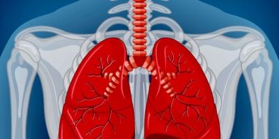 Brasil faz 1º autotransplante de pulmão em paciente com câncer metastático